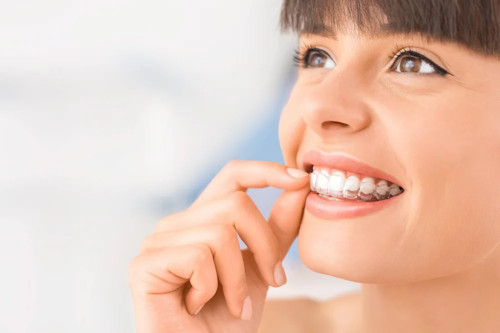 Mountain Brook Invisalign 2